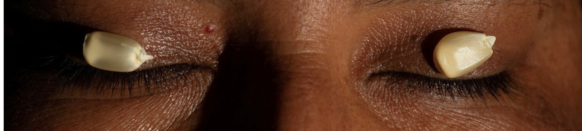 banner_Preexistencia